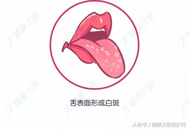 看看自己的舌头,如果是这种颜色就要注意啦!