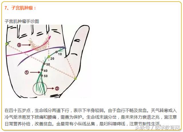 最常见的21种手诊图,中医人必会!