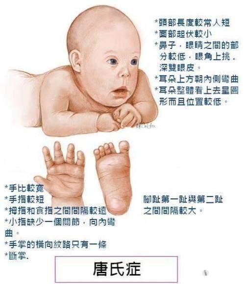 孕妈如何避免唐氏婴儿?孕妇做到以下3点可预防唐氏宝宝