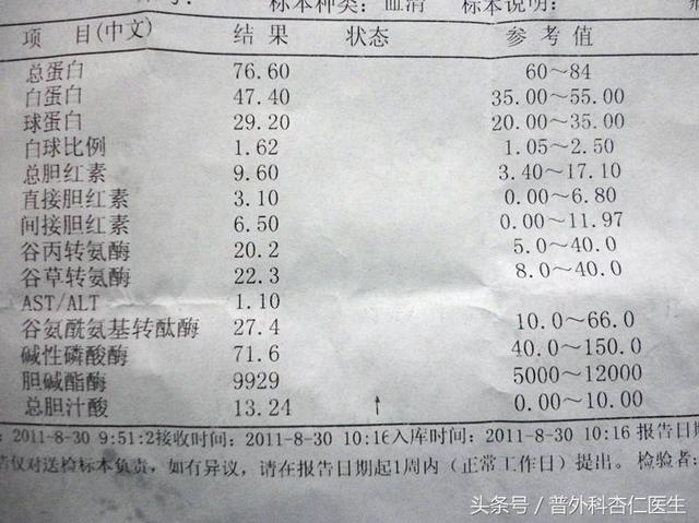 让你稳稳的摆脱医生,手把手教你解读"肝功能化验单"