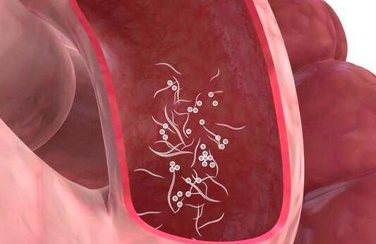 宝宝蛲虫病表现