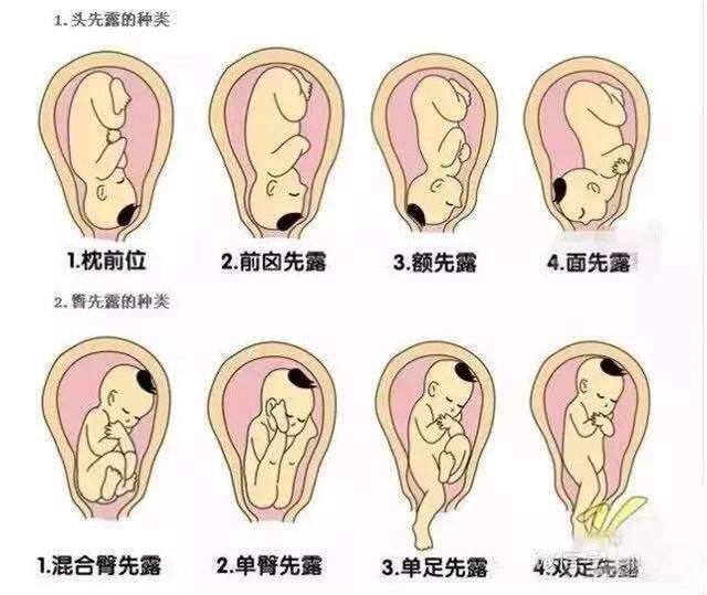 一般怀孕5个月后,孕妇可以感受到胎儿的活动,它是在子宫内伸手踢腿