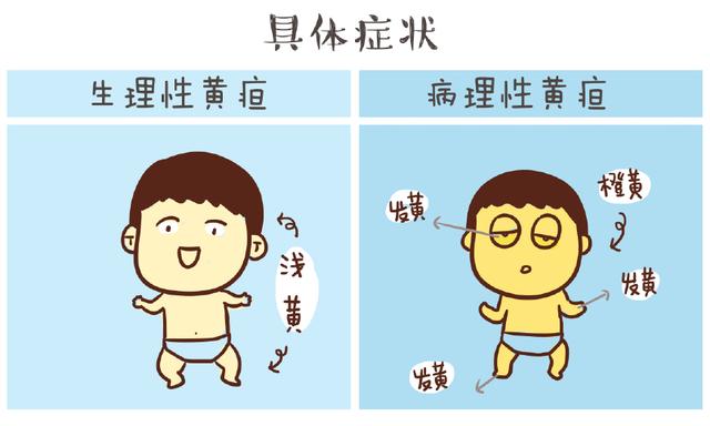 5张图告诉你，生理性黄疸VS病理性黄疸有什么区别
