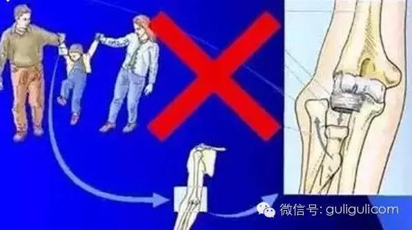 禁止这样牵孩子走路，手废了！