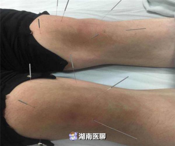 38岁孕妈产后膝关节疼痛难忍，疑惑：坐月子没着凉也会酸疼吗？