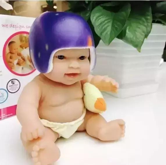 宝宝偏头,歪头影响竟然这么大?现在纠正还来得及吗?