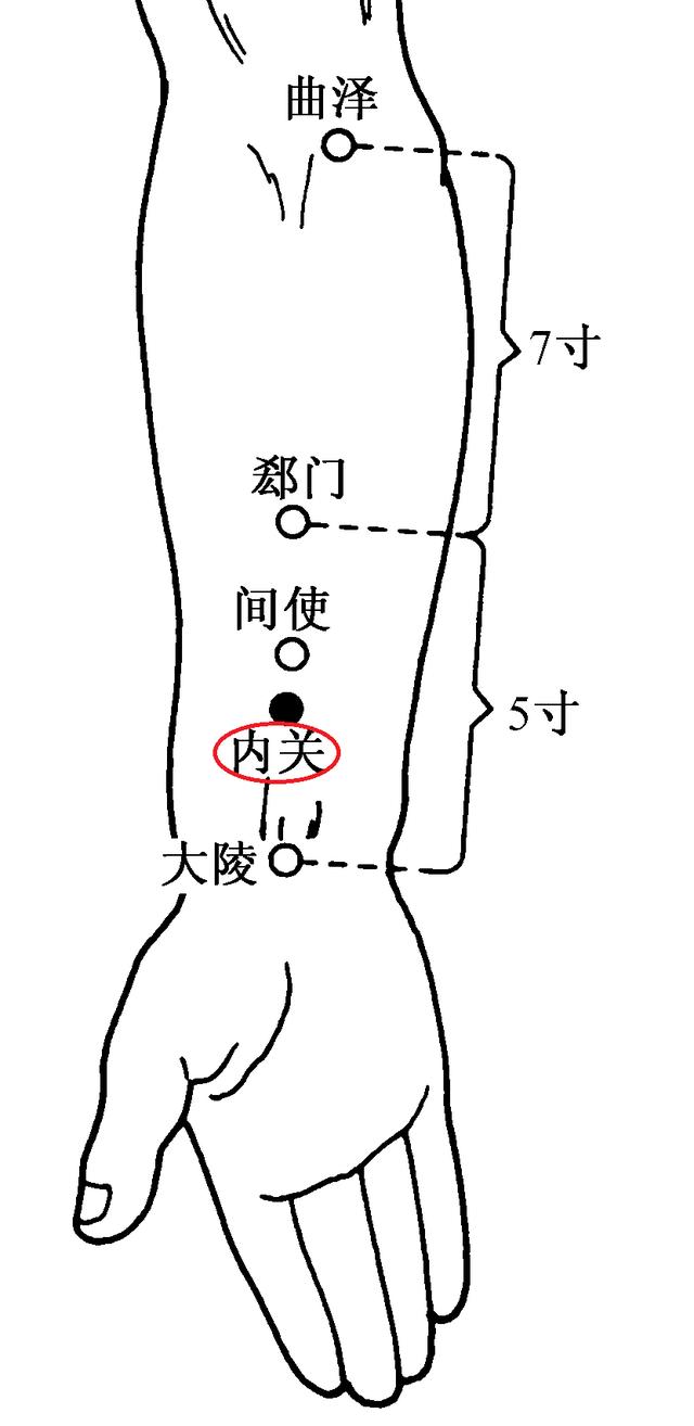 只需几针,痛苦立缓——胃痉挛的针灸治疗