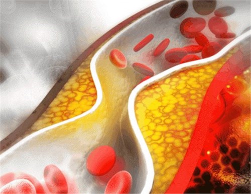 Ѫ�ܶ���, ȫ������! �⼸������, ��ȫ��ѪҺ��ͨ����! ���¶�!