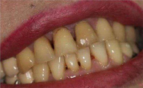 ����һ������������ˢ����30��Ļ����ڳ�ȫ��ȥ��⣬�·�������