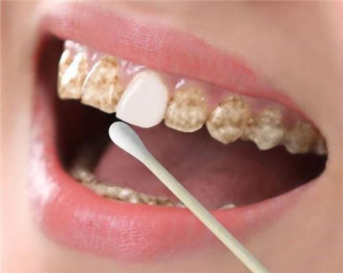 ����һ������������ˢ����30��Ļ����ڳ�ȫ��ȥ��⣬�·�������