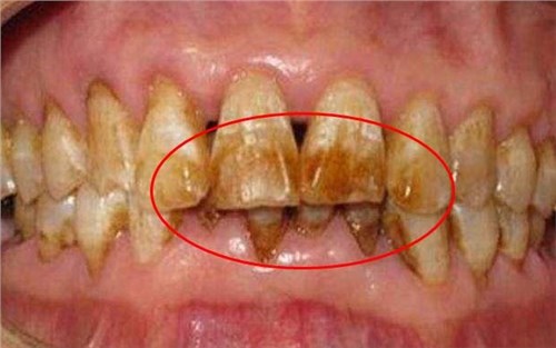 ˢ��ֻҪһ��������20��Ļ����ڳ�ȫ��һ�ɶ������ܶ��˶���֪��