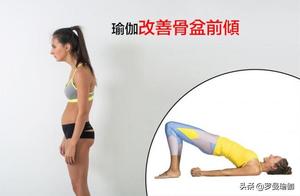 Pelvic Correction: 4 Classic Exercises to Improve Pelvic Tilt, Correct Posture!