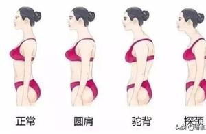 Yoga Shoulder Opening Exercises: Simple Ways to Enhance Your Appearance!
