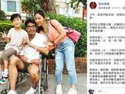 37-Year-Old Fitness Influencer Suddenly Suffers Stroke; Normal Physical Examination - What's the Cause?