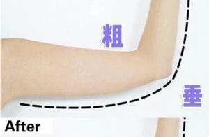 Eliminate (Giraffe Arms) in One Month: Find the Right Method for Maximum Results