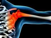 (Frozen Shoulder) Still Tormenting You? Five Exercises to Relieve Pain