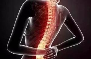 Rest or Exercise? What to Do for Lumbar Disc Herniation?