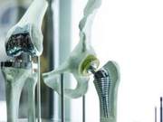 What to Pay Attention to After Knee Replacement Surgery: Outpatient Rehabilitation and Exercise