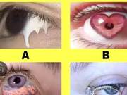 Which Eye Makes You Feel Uncomfortable? Test If You've Fallen for the Right Person?