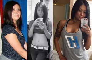 What to Do to Lose Weight After Binge Eating?
