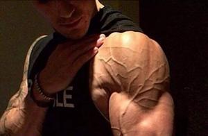 How Important is Reducing Body Fat for Fitness Enthusiasts?