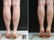 Decoding the Reason Why Your Calf Muscles Won't Go Away
