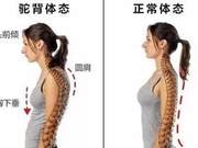 Home Back Training: 5 Exercises to Improve Rounded Shoulders and Hunchback, Restore Posture and Youthfulness