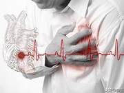 Confirmed Coronary Heart Disease: How Should Patients Exercise Correctly?