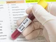 Does Exercise Cause High Uric Acid? Doctors Remind: Reasonable Exercise is Important