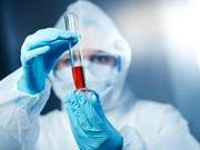 The Pandemic's Impact: Who is to Blame?