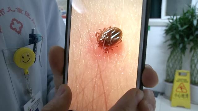 #你的育儿经#3岁女童油菜花地里游玩拍照 回到家脖子后的东西吓坏父母
