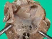 Restrictive Cardiomyopathy in Cats: Clinical Characteristics and Management