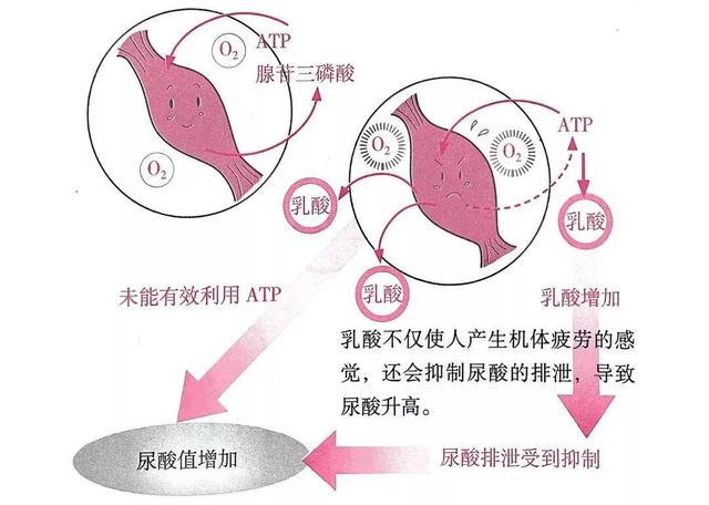 还没富贵就得了“富贵病”！把精力全部倾注于事业的人要注意