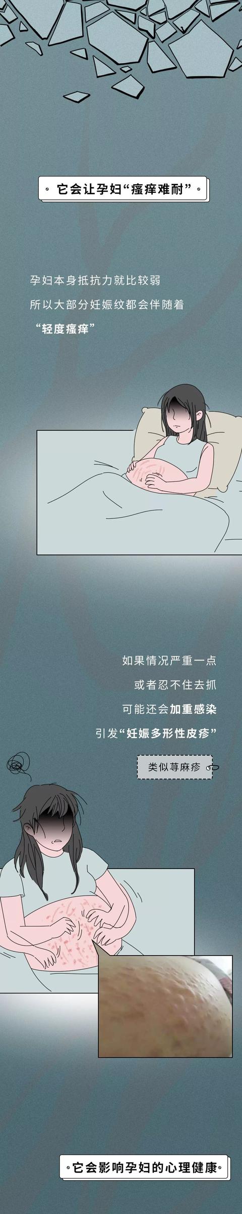 『超级宝妈』妊娠纹真的会遗传？告诉你有关妊娠纹的几个冷知识