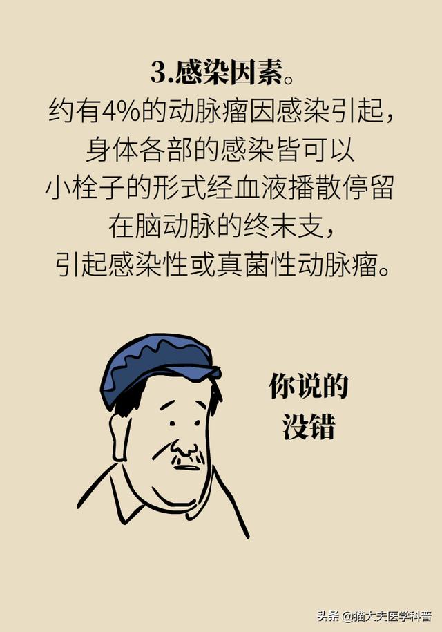 脑动脉瘤之一：脑动脉瘤是脑卒中吗？