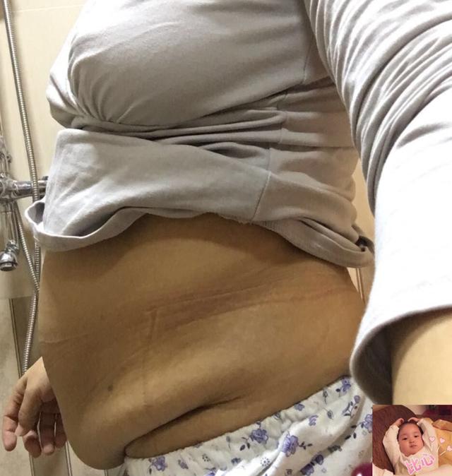 幸福的灯火|女性生完娃前后会出现哪些变化？过来人表示：“从里到外都变了”