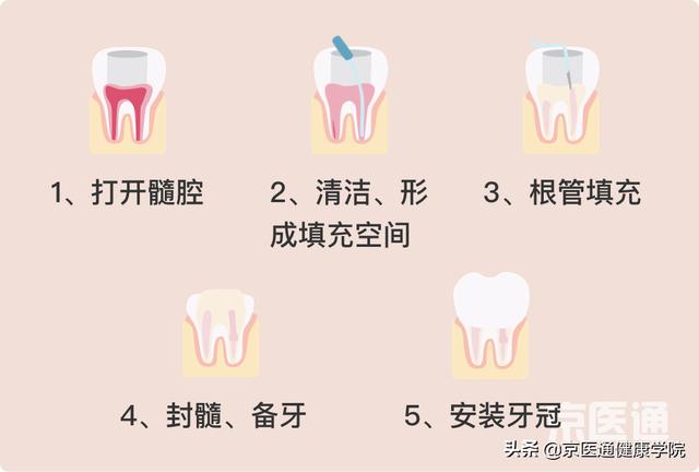 「牙痛神药」真的有用么？口腔医生说出了真相