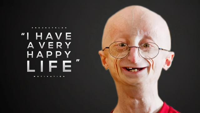 首个儿童早老症疗法Zokinvy获批，生存期增加2.5年