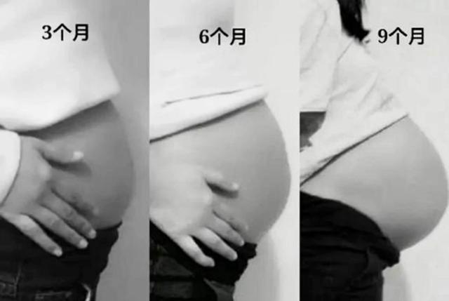 星星点灯|妻子头胎孕检被“误诊”为第二胎，丈夫脸发绿，医生忙道歉
