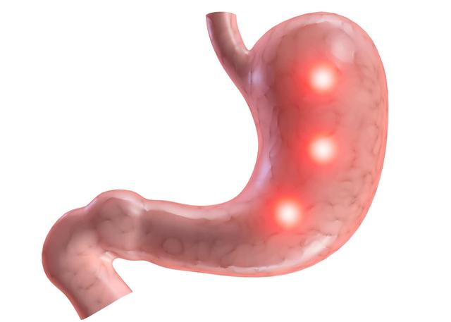 长期吃腌肉更易患癌症？虽深受人们喜爱，但三点毋庸置疑