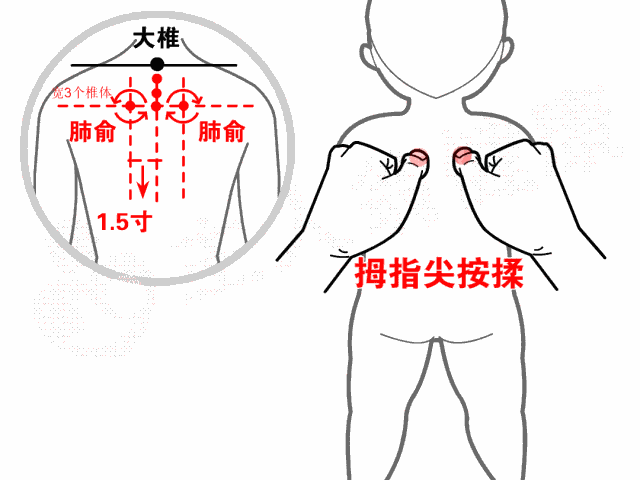「你的育儿经」家长没敢去看病，拖成严重肺炎，会点小儿推拿就好了