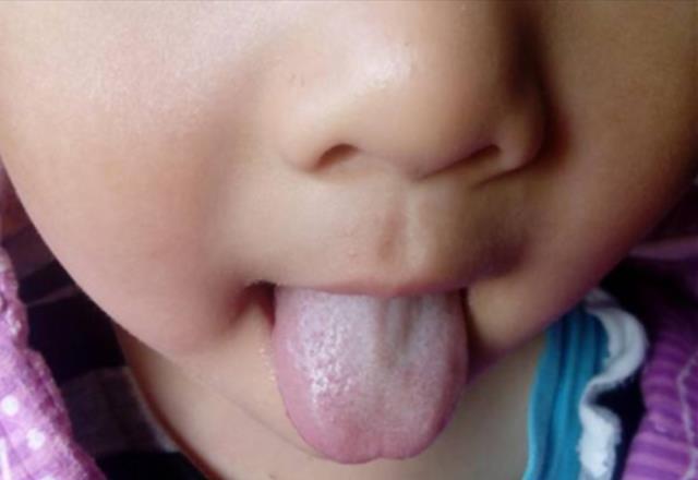 5岁孩子因&quot;喝水&quot;导致积食，医生：给娃喝水，要避开这3个时间