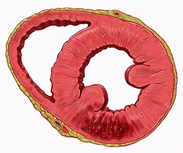 心脑血管疾病发生的原因有哪些？医生：6类因素容易被忽视