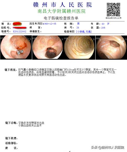 赣州市人民医院消化内科成功治愈一疑难小肠出血患者