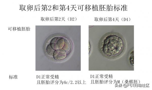 生活矜持点|试管婴儿胚胎评分和胚胎移植、冷冻、丢弃标准