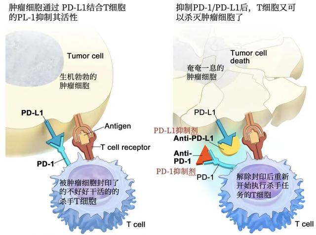 肺癌如何选择PD-1/PD-L1药物？这里有一份最新指南