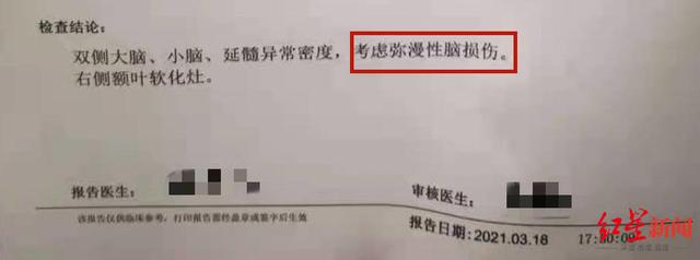 拔牙|男童拔牙后昏迷40天，拔牙有风险？华西口腔医院专家：拔牙本身不会导致昏迷