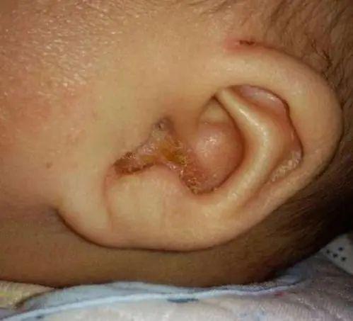 宝宝身上有4个“耐脏”部位，家长平时别勤洗，小心好心办坏事