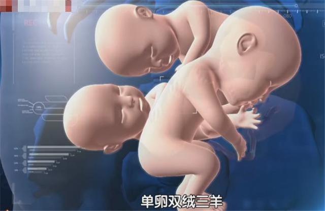 「你的育儿经」90后孕妇幸运怀上3胞胎，喝水都会孕吐，胎儿7个半月面临早产
