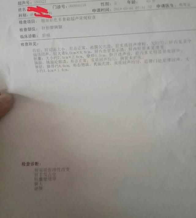 中药治肝癌肿瘤，一疗程后肿瘤开始缩小